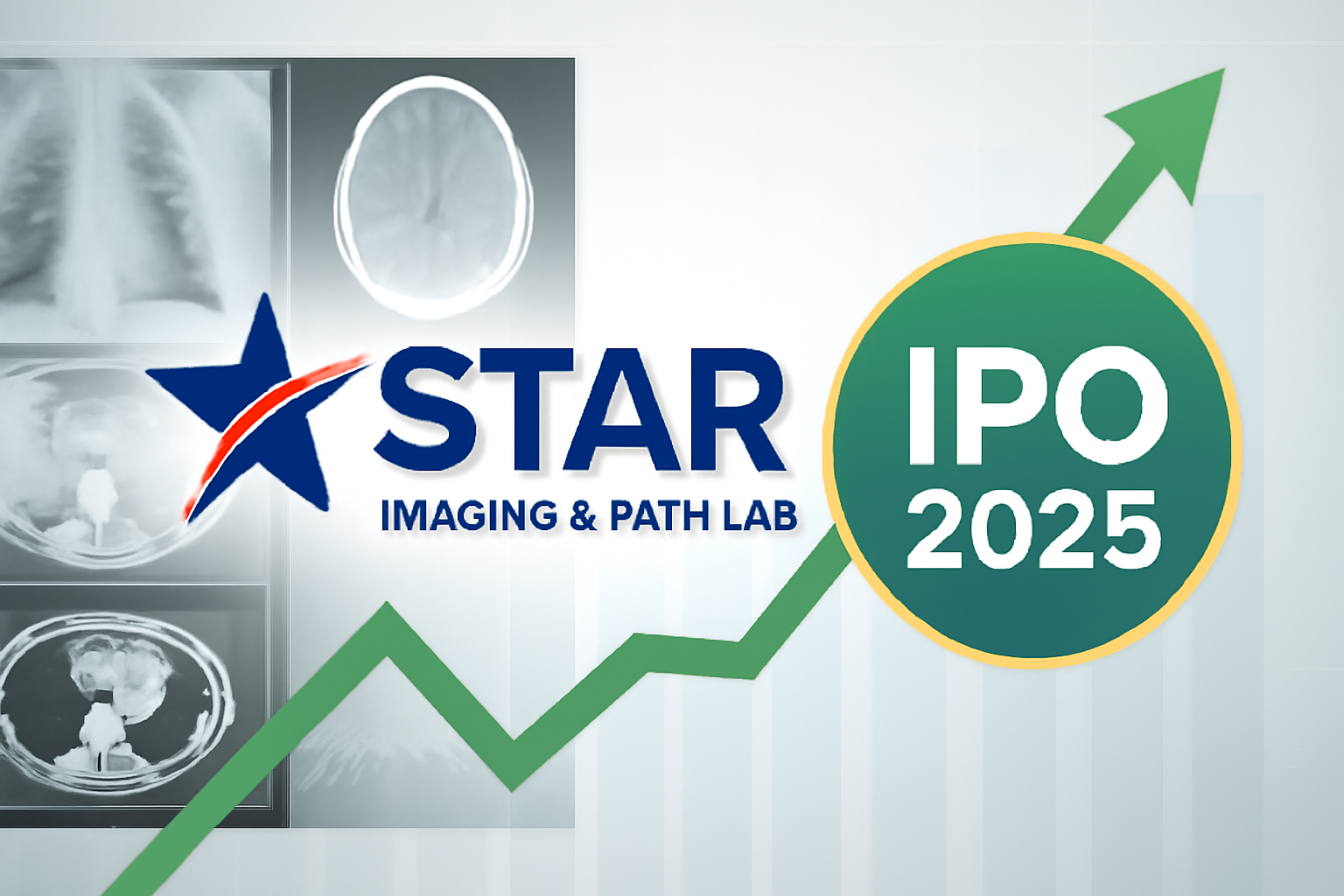 Star Imaging IPO GMP Today: Latest Updates, Price Band, Subscription Status, and Review (August 2025)